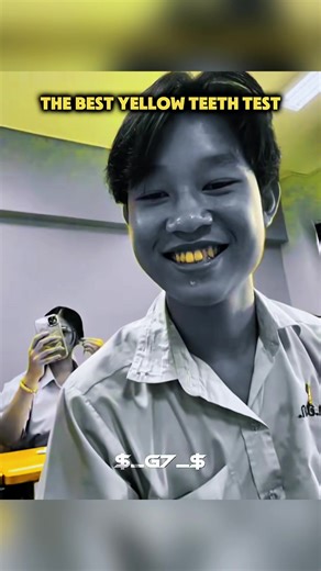 #capcut #capcutpioneer #Challenge #yellow #troll Yellow teeth in England 🇬🇧 🇺🇸 Yellow teeth filter🔥☠️. yellow teeth test filter. Do you dare to challenge whether your teeth are white? Apakah Anda berani menantang apakah gigi Anda putih? Filtro dientes amarillos 🔥☠️. Prueba del filtro dientes amarillos. Filtre dents jaunes 🔥☠️. Test du filtre dents jaunes. Oserez-vous voir si vos dents sont vraiment blanches ?Gelbe Zähne Filter 🔥☠️. Gelbe Zähne Test Filter. Traust du dich, zu testen ob de