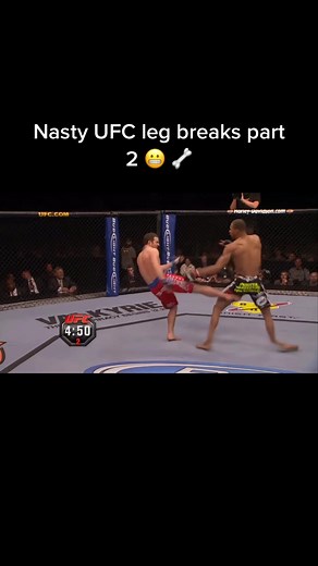 Corey Hill suffers a nasty leg break at a UFC event back in 2008 🦴😳 What other MMA injuries would you wsnt to see on here? #ufc #mma #boxing #fight #fighting #brokenleg #injury #nasty #ouch #fyp #mmafighter #ufctiktok