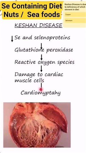 Why So Big HEART due to a mineral's deficiency💔 #Healthanddisease#Nutritionaldisorder#Keshandisease