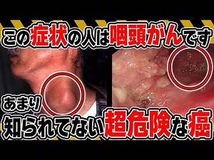 【放置厳禁】あまり知られていない超危険な癌である「咽頭がん」の症状とは？ 早期発見の方法についても徹底解説【医師監修】