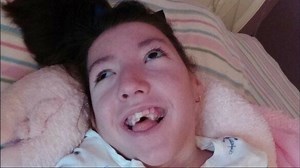 Years later, meningitis survivor continues to battle physical, financial aftermath