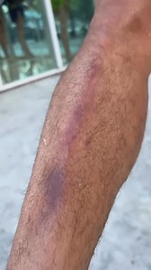 Warrior marks 💢 Will Nong-O get revenge when he rematches Kongthoranee in the main event of ONE Fight Night 31 on Prime Video? | ONE Championship