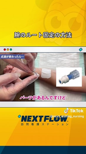 腕のルート固定方法と看護技術