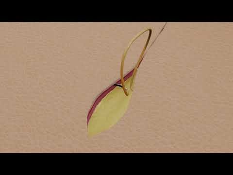 Suture Techniques - Subcuticular Running Suture