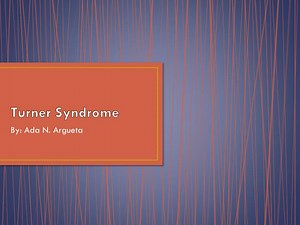 Turner Syndrome - SlideServe