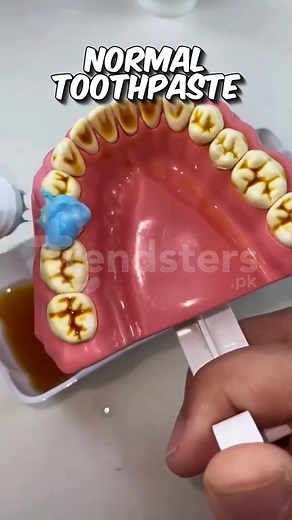 ✨ Body Accel Whitening Toothpaste – Bright Smile, Fresh Confidence! Say goodbye to stains and hello to a naturally white, radiant smile! Body Accel Whitening Toothpaste removes yellowing, freshens breath, and strengthens enamel — all in one powerful formula. 💎 Benefits: ✔ Removes tea/coffee/smoke stains ✔ Naturally whitens teeth ✔ Long-lasting fresh breath ✔ Strengthens enamel & reduces sensitivity ✔ Safe for daily use 📦 Perfect for: Daily whitening, smokers, tea/coffee lovers 👉 Order Now: Wh