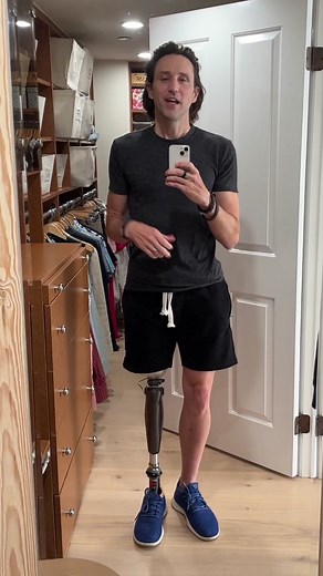 How I Walk with My Prosthetic Leg: A Personal Journey