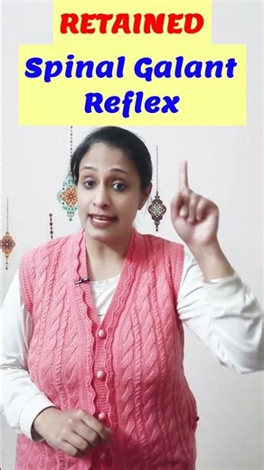 3 Signs RETAINED Spinal Galant reflex!