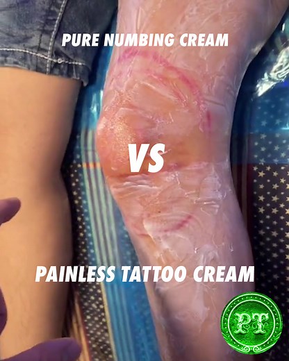 1M views · 4.6K reactions | Numbing cream review & comparison using Painless Tattoo & Pure on two different spots 樂 Who won?  Credit: @yetitears Shop Now: painlesstattoo.co/products/5-tubes Shop Now: painlesstattoo.co/products/5-tubes | Painless Tattoo | Facebook