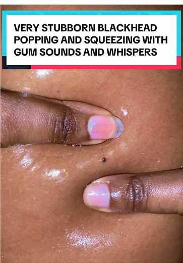 #blackhead #fyp #viral #trending #asmr