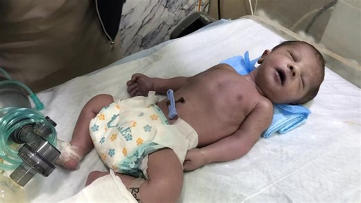 Newborn Not Breathing! A CPR & Ambu Bag Emergency in Delivery Room | Neonatal Care