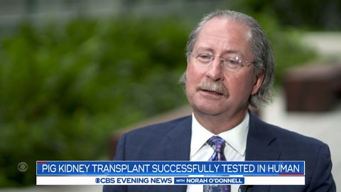 Doctors complete first successful pig-to-human kidney transplant