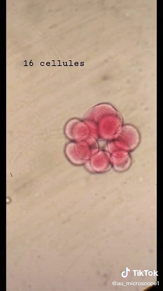 Stages of Development of a Sea Urchin