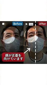 橋出血／複視・眼振／40代｜“仕事復帰”想いを支えるリハビリ事例#リハビリ #脳出血 #脳出血リハビリ #脳梗塞 #脳梗塞リハビリ #自費リハビリ#脳神経リハビリセンター#歩行リハビリ #歩行