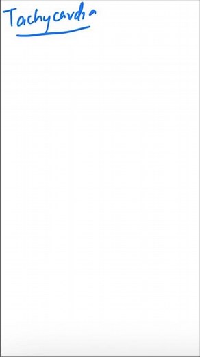 tachycardia algorithm #shorts