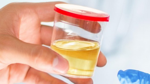 Qld researchers cure cervical cancer in mice using gene-editing tool