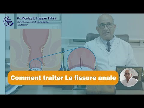 Pr. Moulay EL Hassan Tahiri-La fissure anale et comment peut-on la traiter.