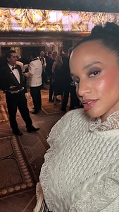 DASCHA POLANCO on Instagram: "In the last 5 years I have had issues with acne, this was a first for me. I had tried soo many things and now it’s under control but who knows. I love to take care of my skin and try new things for prevention, maintenance and enhancement! #Ismellgood"