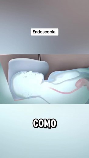 Como é feito o exame de endoscopia?