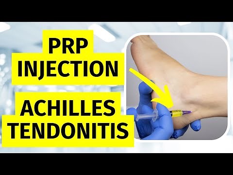 PRP Injection for Achilles Tendinopathy