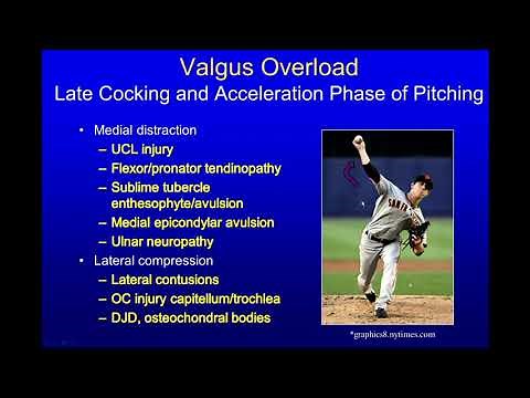 Imaging of the elbow