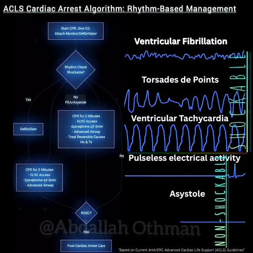 9.1K views · 1K reactions | ACLS Cardiac Arrest Algorithm:Shockable...