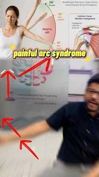 💪😣 Painful Arc Syndrome