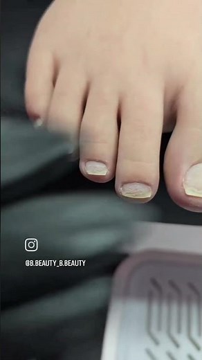 Transformation Pieds : Avant / Après une Pédicure Complète ! 😱✨
