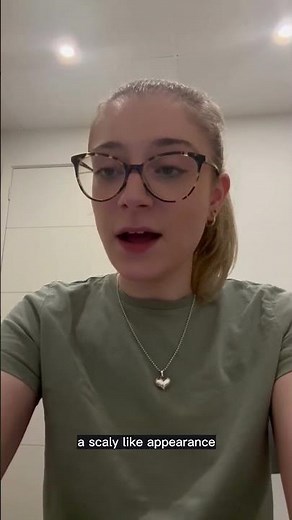 What does dermatitis on feet look like?