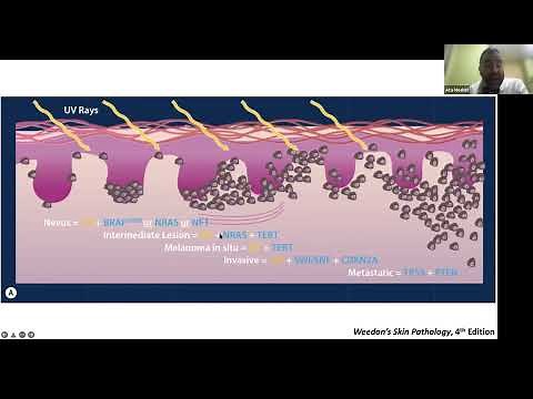 21st Century Dermatopathology: Molecular Diagnostics for Melanocytic Neoplasms