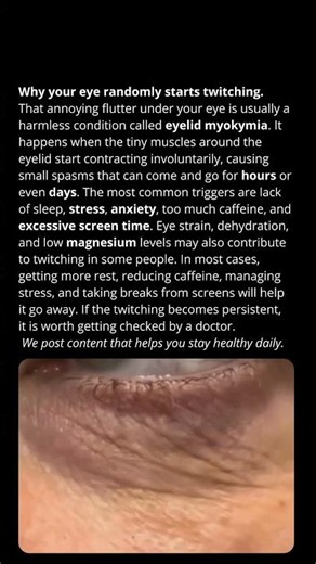 Why your eye randomly starts twitching.