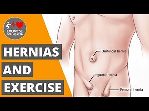 Is exercising with a hernia safe?