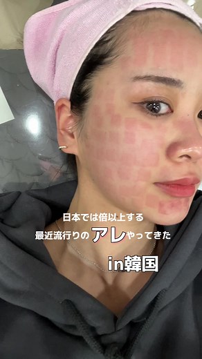 韓国美容皮膚科でのポテンツァ体験