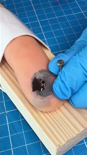 This needle trick removes nail blood instantly #drainage #oddlysatisfying