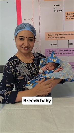 Dr Sushma on Instagram: "Dangers of breech baby 1.leaking 2.Cord prolapse"