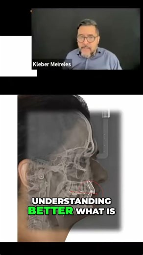 Unlock Your Smile Secrets: Cephalometric Analysis Explained #shorts