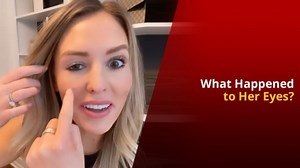 Wrong Botox Surgery Leaves Influencer With Drooping Eyelid