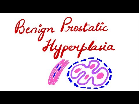 BENIGN PROSTATIC HYPERPLASIA- PATHOLOGY