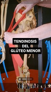 Veronica Lercari on Instagram: "Tendinosis del glúteo menor #gym #gimnasia #verler #fitness #saludable #deportes #veronicalercari #fit #gimnasiaencasa #terapiafísica #kinesiologia #kine #fisioterapia #traumatologia #danza #pilates #gimnasiaverler"