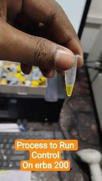 Process to Run Control in ERBA 200 Biochemistry Analyser #lablife #labtech #labtechnician