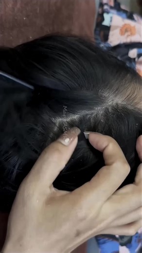 Removing Itchy Dry Scalp Dandruff (Dandruff Scratching)