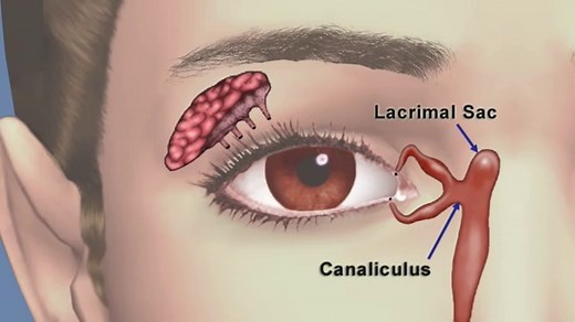 Lacrimal Gland