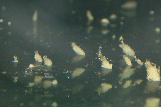 Pineapple Sponges: Do They Stay or Do They Go?