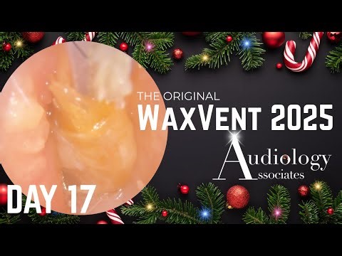 Dry Keratin “Husk” Stuck to Eardrum! - Waxvent Day 17