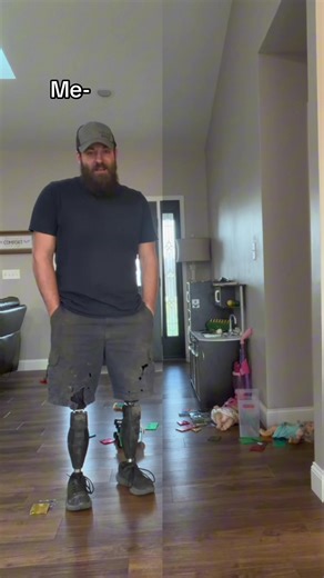 Literally.. #limblossboss #dreamteamprosthetics #myleglesslife