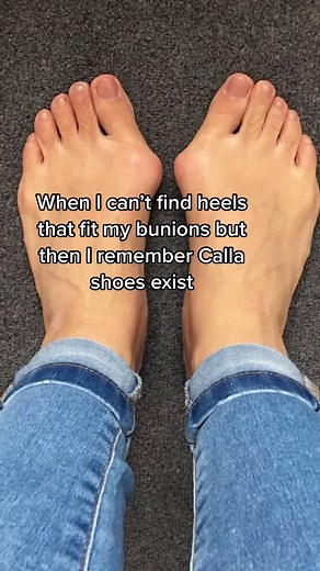 Comfortable Heels for Bunions | Calla Shoes Review