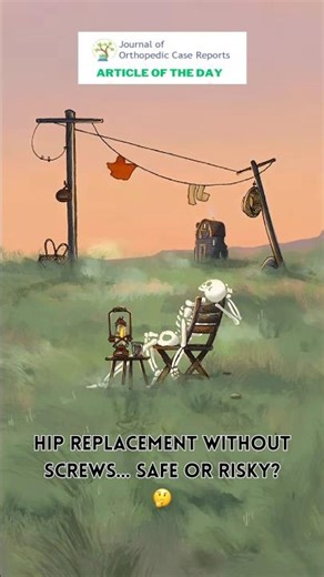 Hip replacement without screws… safe or risky? 🤔