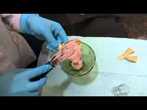 Taking an Awesome Alginate Impression