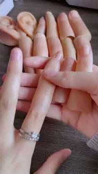 Felt inferior for half my life #Finger Loss #Prosthetic Fingers