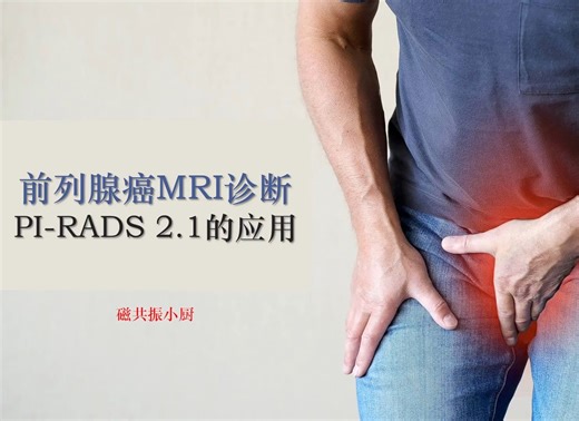 前列腺癌MRI诊断及 PI-RADS 2.1的解读（一）